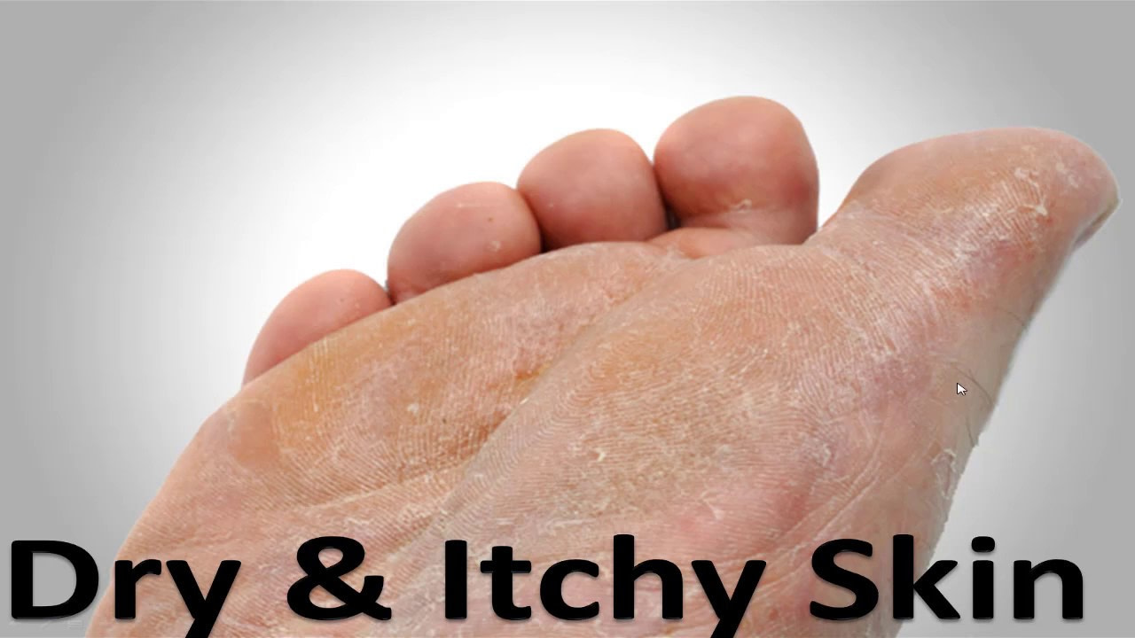 the-best-products-for-dry-itchy-foot-skin-the-best-home-treatment