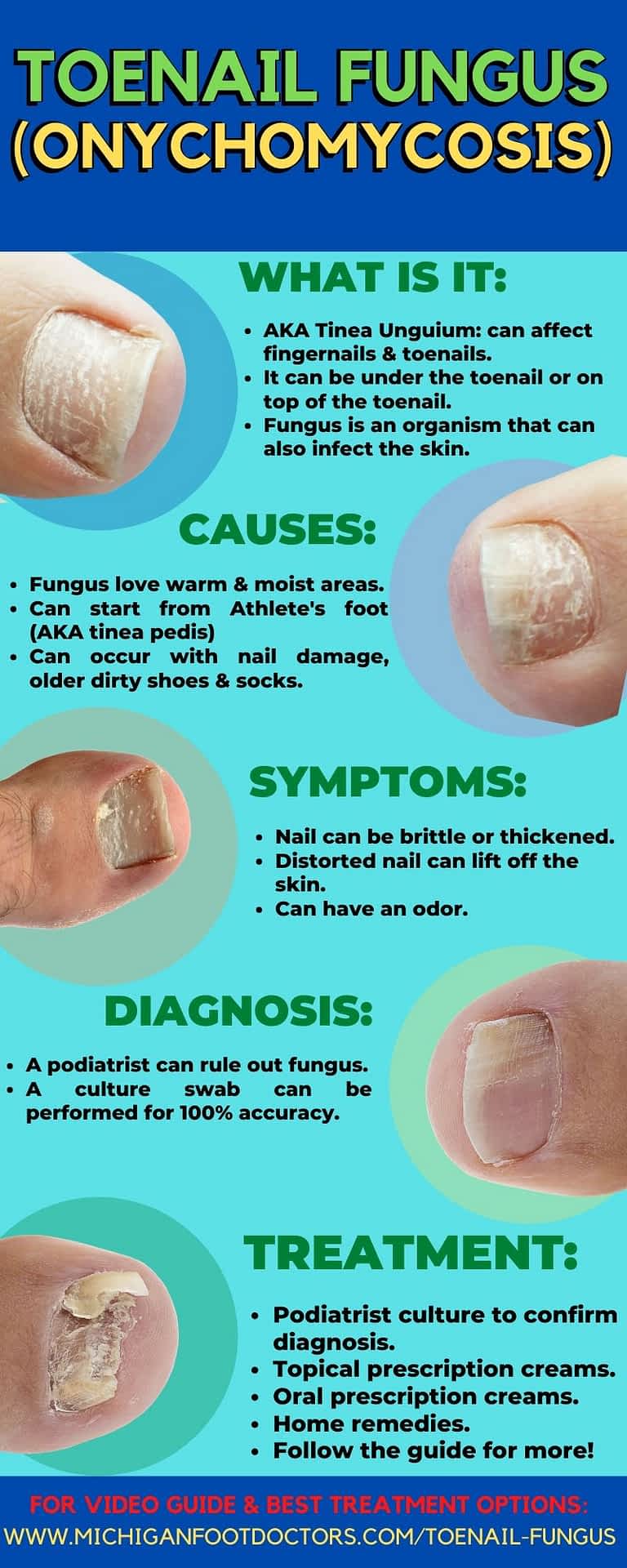 How To Clear Up Toenail Fungus Naturally