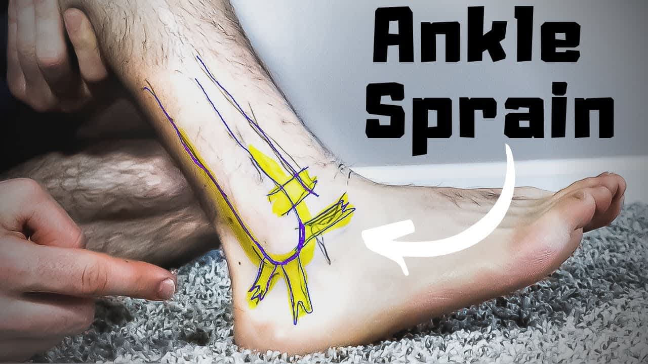 Sprained Foot Healing Time How Long & How To Speed It Up