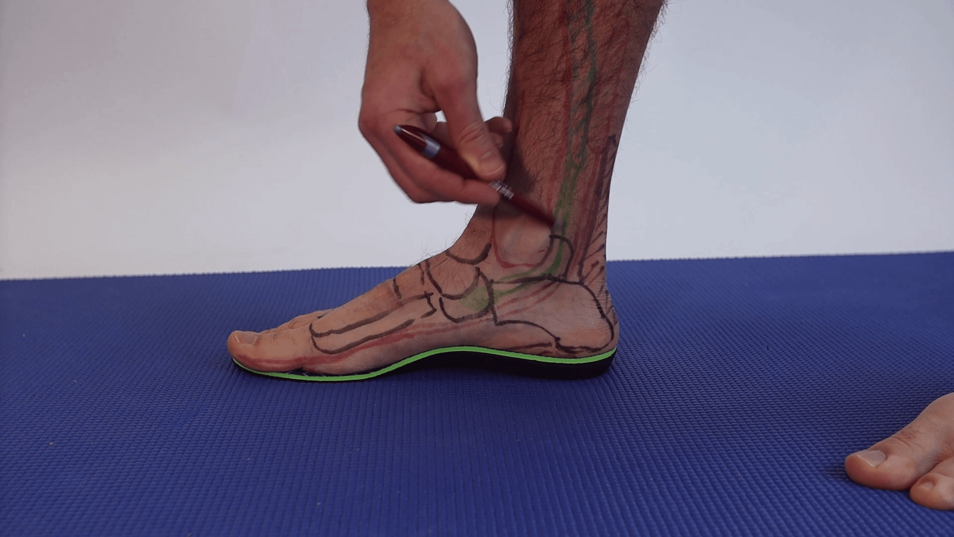 best insoles for tendonitis