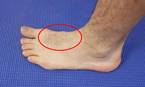 inner foot arch pain