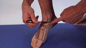 Accessory Navicular Bone Pain [Causes, Symptoms & Best Treatment]