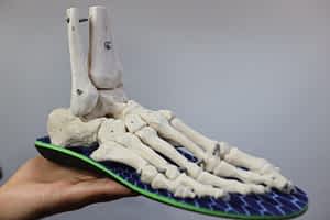 bone growth on side of foot
