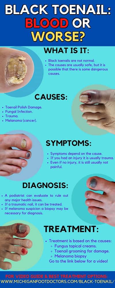 Black Streaks Under The Nails Causes Symptoms Best Treatment