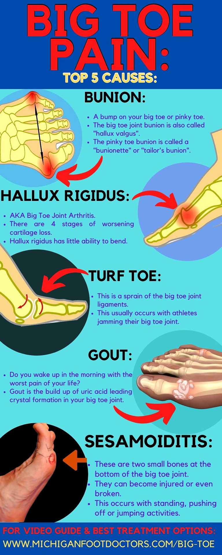 how-to-prevent-toenail-fungus-foot-care-youtube