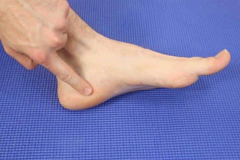 best treatment for bruised heel