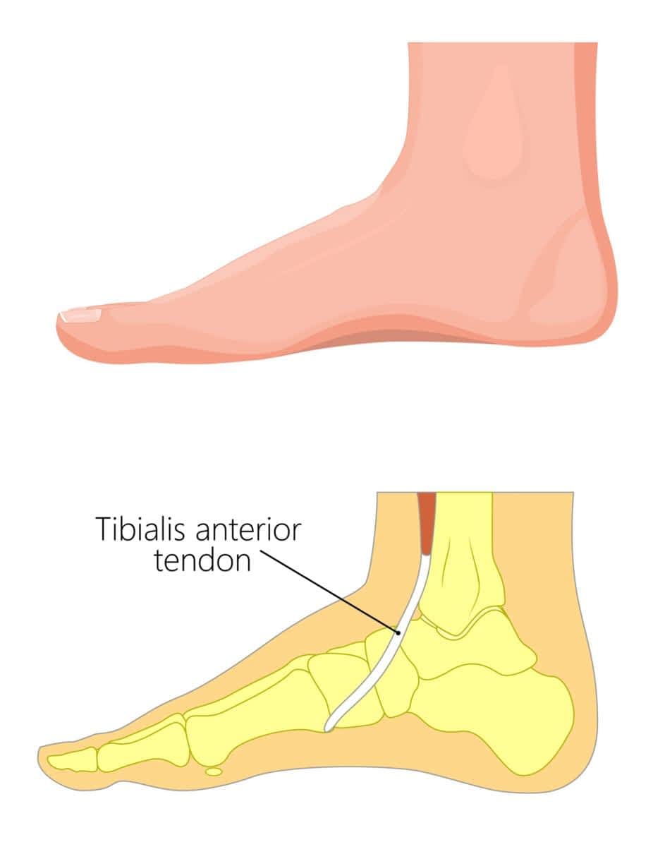 Top of Foot Tingling [Causes, Symptoms & Best Treatment]