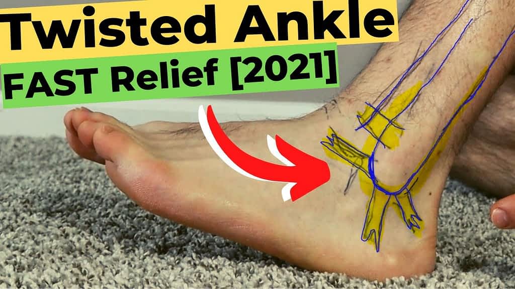 Sprained ankle dayz standalone что делать