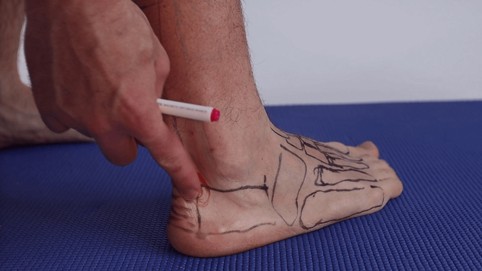 pinching pain in heel
